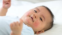 Comment soigner les plaques de dartre chez le bébé et le jeune enfant ?