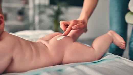 Quelles sont les causes des boutons sur les fesses du bébé et de l’enfant ?