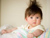 Qu’est-ce que la maladie des cheveux incoiffables, un syndrome rare qui touche les enfants ?