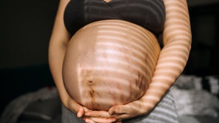 Pourquoi le ventre de la femme enceinte noircit ?