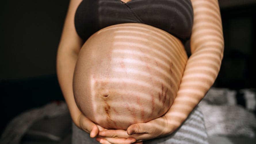 Pourquoi le ventre de la femme enceinte noircit ? | PARENTS.fr