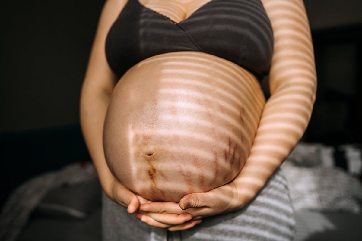 Ligne de grossesse sur le ventre, faut-il s'inquiéter ?