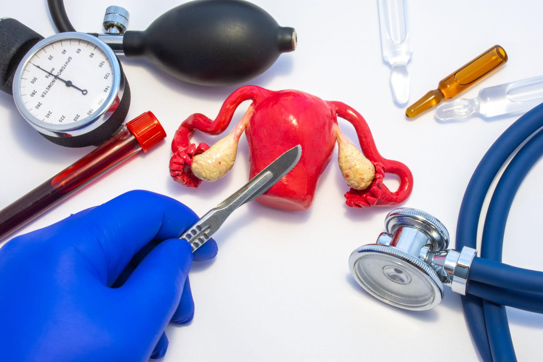 Hystérectomie Quand Retirer Le Uterus ETDKHL — free download