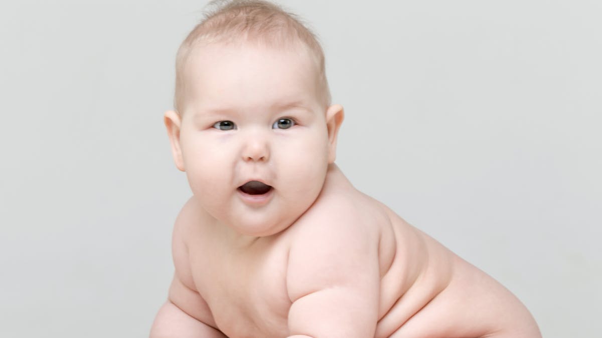 Bébé obèse ou en surpoids  : définition, causes, symptômes, traitements 