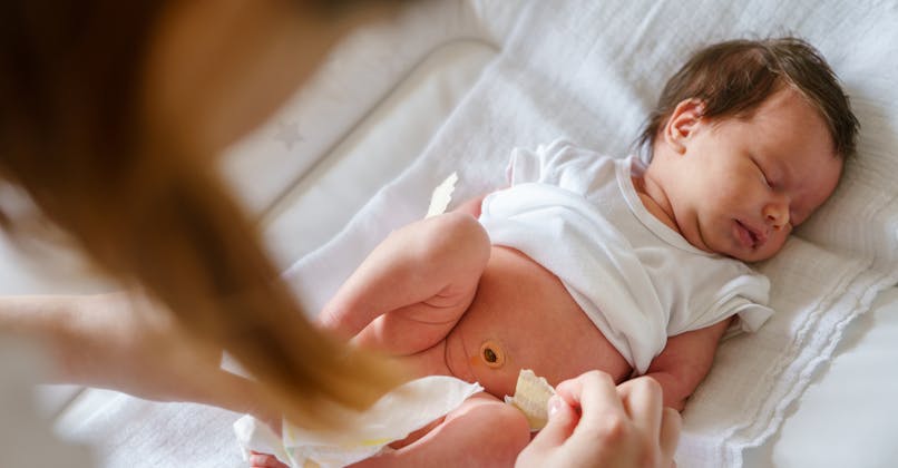 Causes Symptomes Traitements Le Point Sur L Omphalite Chez L Adulte Et Le Nouveau Ne Parents Fr Causes Symptomes Traitements Le Point Sur L Omphalite Chez L Adulte Et Le Nouveau Ne Parents Fr