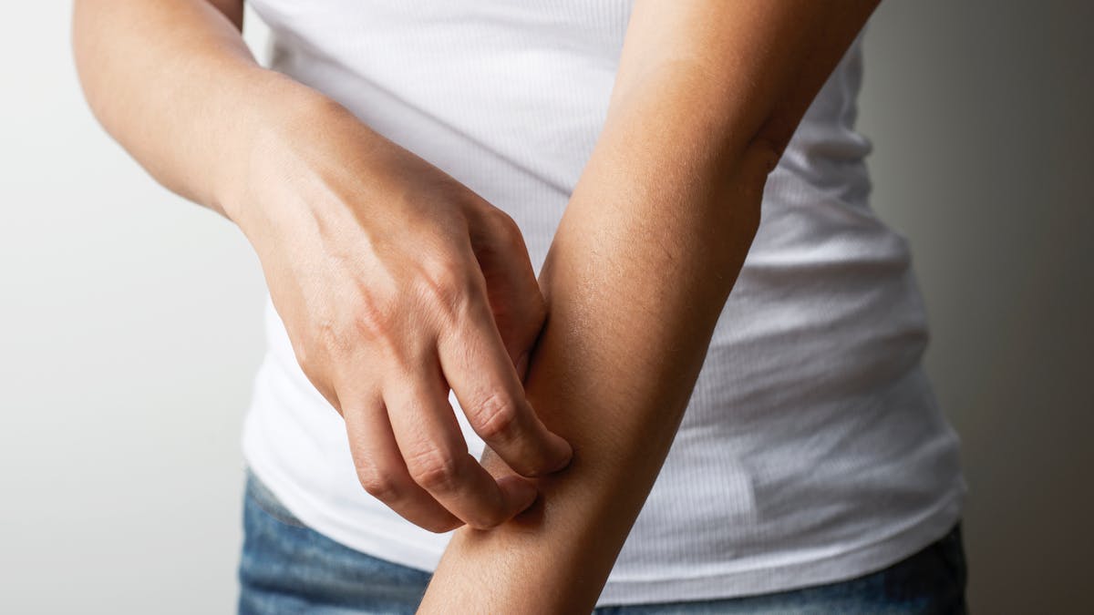 Traitement Symptomes Que Faire En Cas De Morsure D Aoutat Parents Fr Traitement Symptomes Que Faire En Cas De Morsure D Aoutat Parents Fr