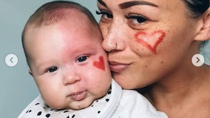 Cette maman fait retirer la tache qui couvre la moitié du visage de son bébé et s'attire les critiques des internautes   