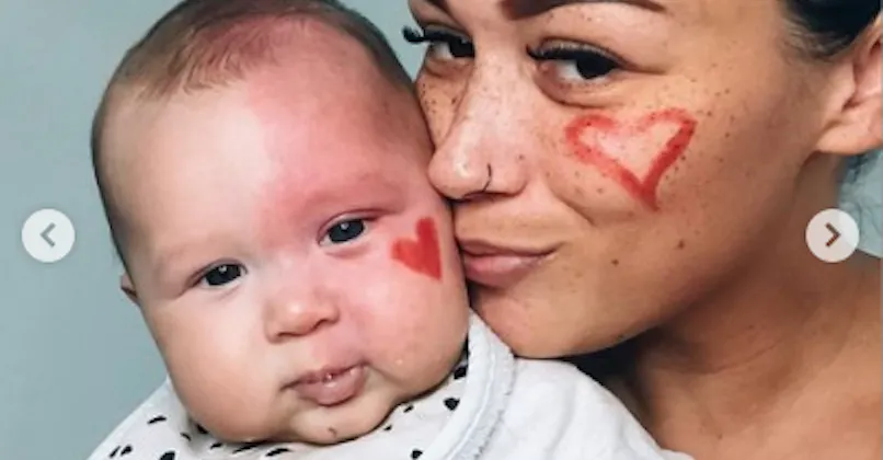 Une Maman Traitee De Monstre Apres Avoir Fait Retirer La Tache De Vin De Son Bebe Parents Fr Une Maman Traitee De Monstre Apres Avoir Fait Retirer La Tache De Vin De Son Bebe Parents Fr