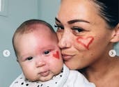 Cette maman fait retirer la tache qui couvre la moitié du visage de son bébé et s'attire les critiques des internautes