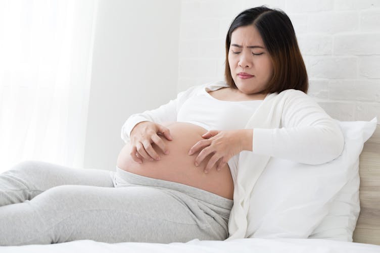 Une femme enceinte se gratte sur le ventre