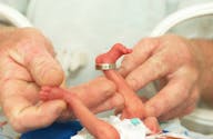Né à 22 semaines de grossesse, ce bébé a miraculeusement survécu