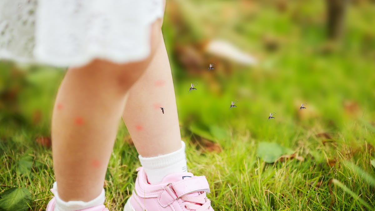 Des moustiques autour des jambes d'une enfant