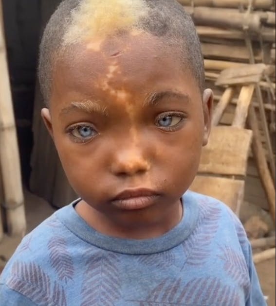 Ce petit garçon à la beauté singulière crée le buzz sur Tik Tok