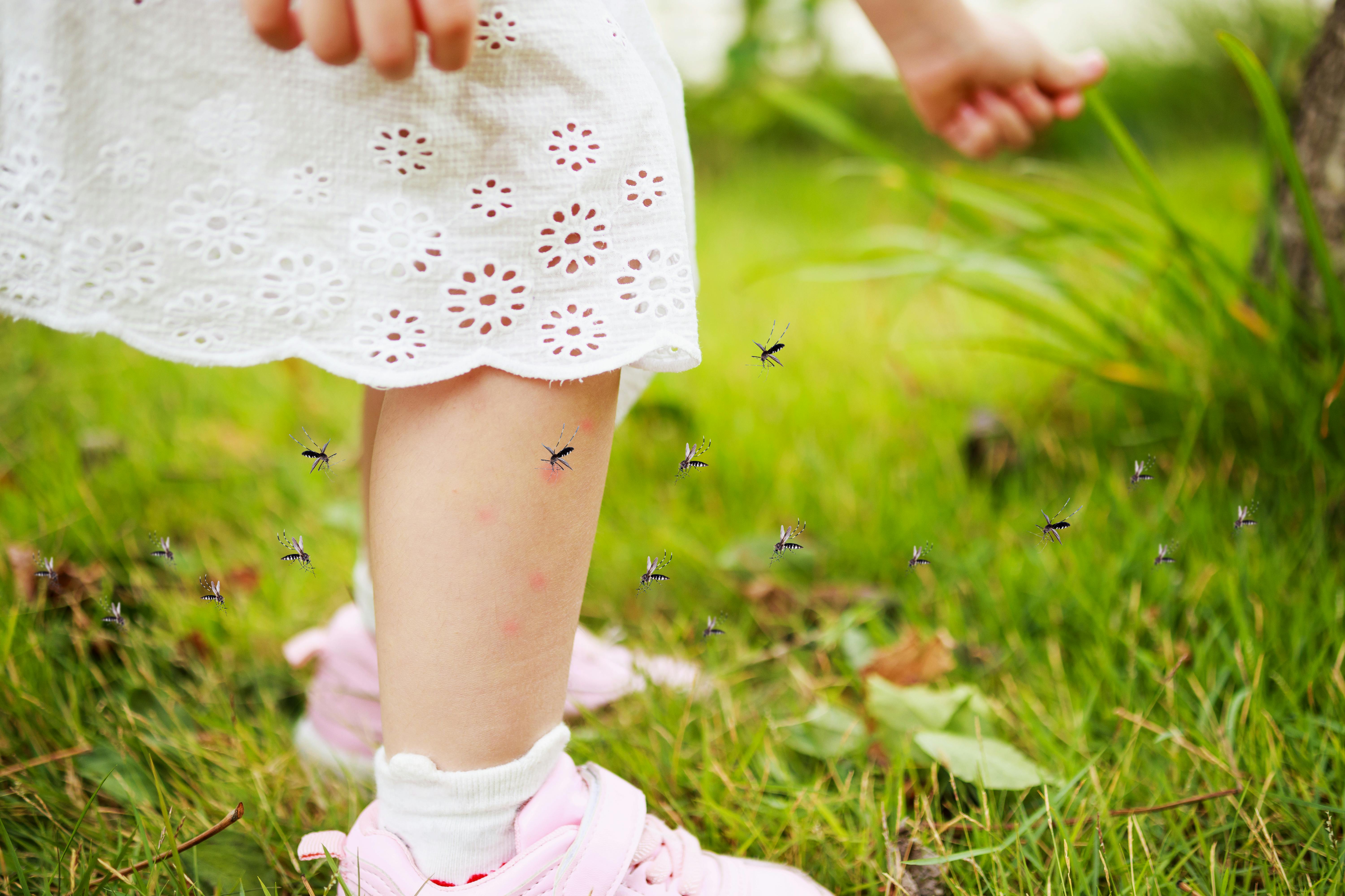 Les Piqures D Insectes Chez L Enfant Et Le Bebe Parents Fr Les Piqures D Insectes Chez L Enfant Et Le Bebe Parents Fr