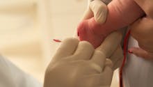 La Haute autorité de santé recommande le dépistage de la drépanocytose pour tous les bébés
