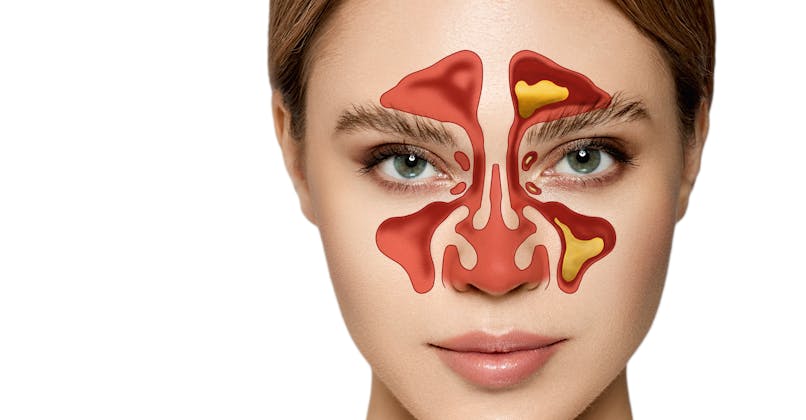 Emplacement des sinus de la face