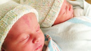 Grossesse : une jumelle sauve la vie de sa sœur dans le ventre de leur mère
