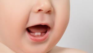 Né avec des dents, ce bébé fait le buzz sur les réseaux sociaux