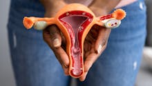 Qu'est-ce qu'un col de l'utérus fermé ?