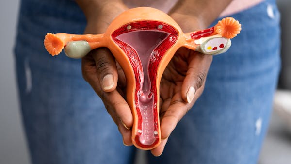 Qu'est-ce qu'un col de l'utérus fermé ?