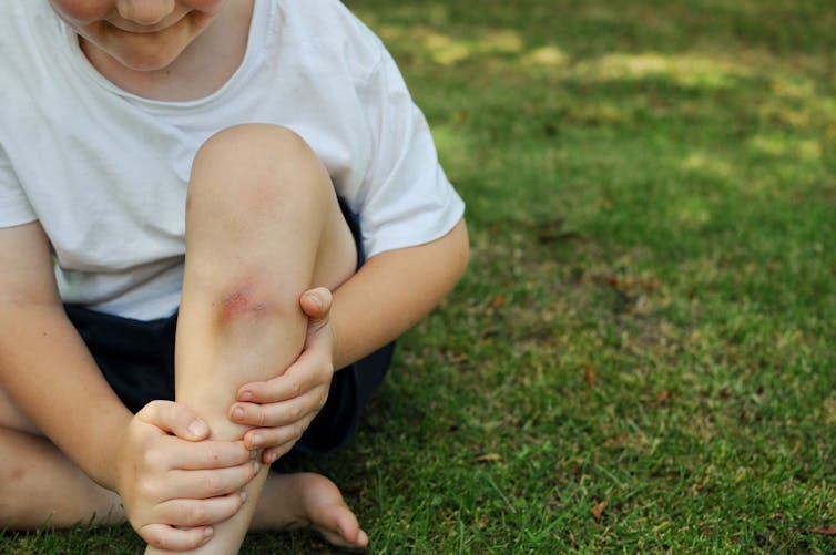 Un enfant blessé à la jambe.