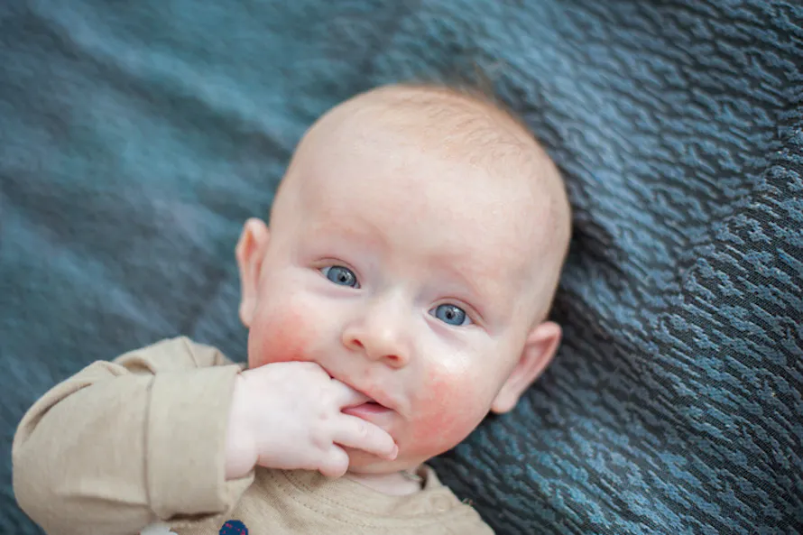 Rouges Head Pourquoi bébé a-t-il les joues rouges ? | Parents.fr