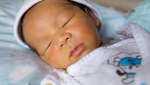 Ictère néonatal : définition, symptômes et traitement