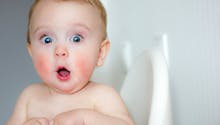 Les yeux d'un bébé changent de couleur après un traitement anti-viral, comment expliquer ce phénomène ?