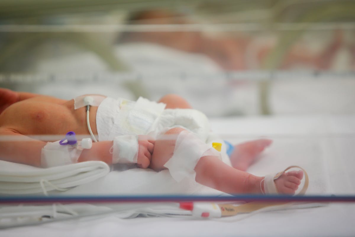 Naissance : les soins immédiats du nouveau-né - Doctissimo