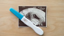 Vésicule vitelline : quel est son rôle dans la grossesse, et quand la voit-on à l’échographie ?
