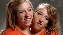 Abby et Britanny, les célèbres sœurs siamoises, se sont mariées (Vidéo)