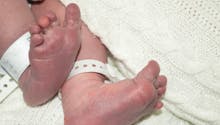 Le combat des parents d’Alice, née avec 26 doigts à cause d'une maladie génétique très rare