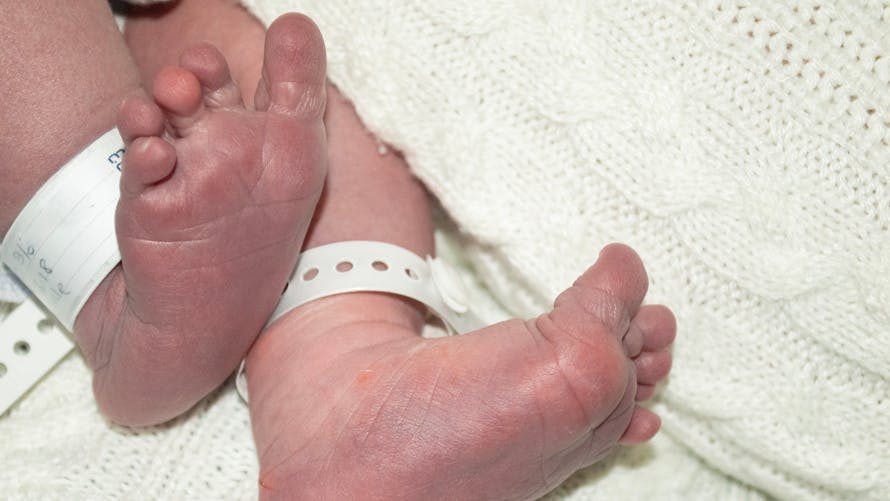  Le combat des parents d’Alice, touchée par une maladie génétique extrêmement rare et née avec 26 doigts 