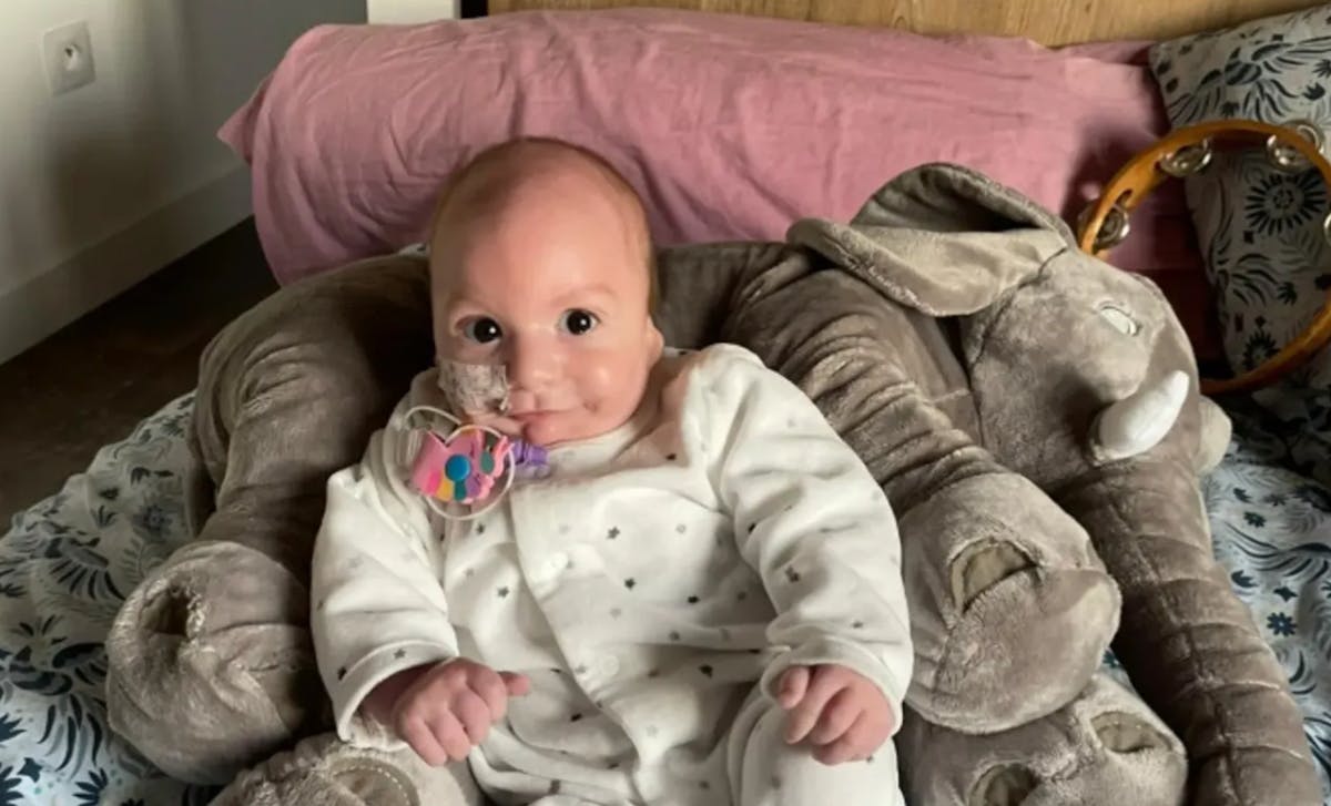 "Elle nous a appris l'amour inconditionnel " : Margot, une fillette de 4 ans née sans oreilles, est décédée