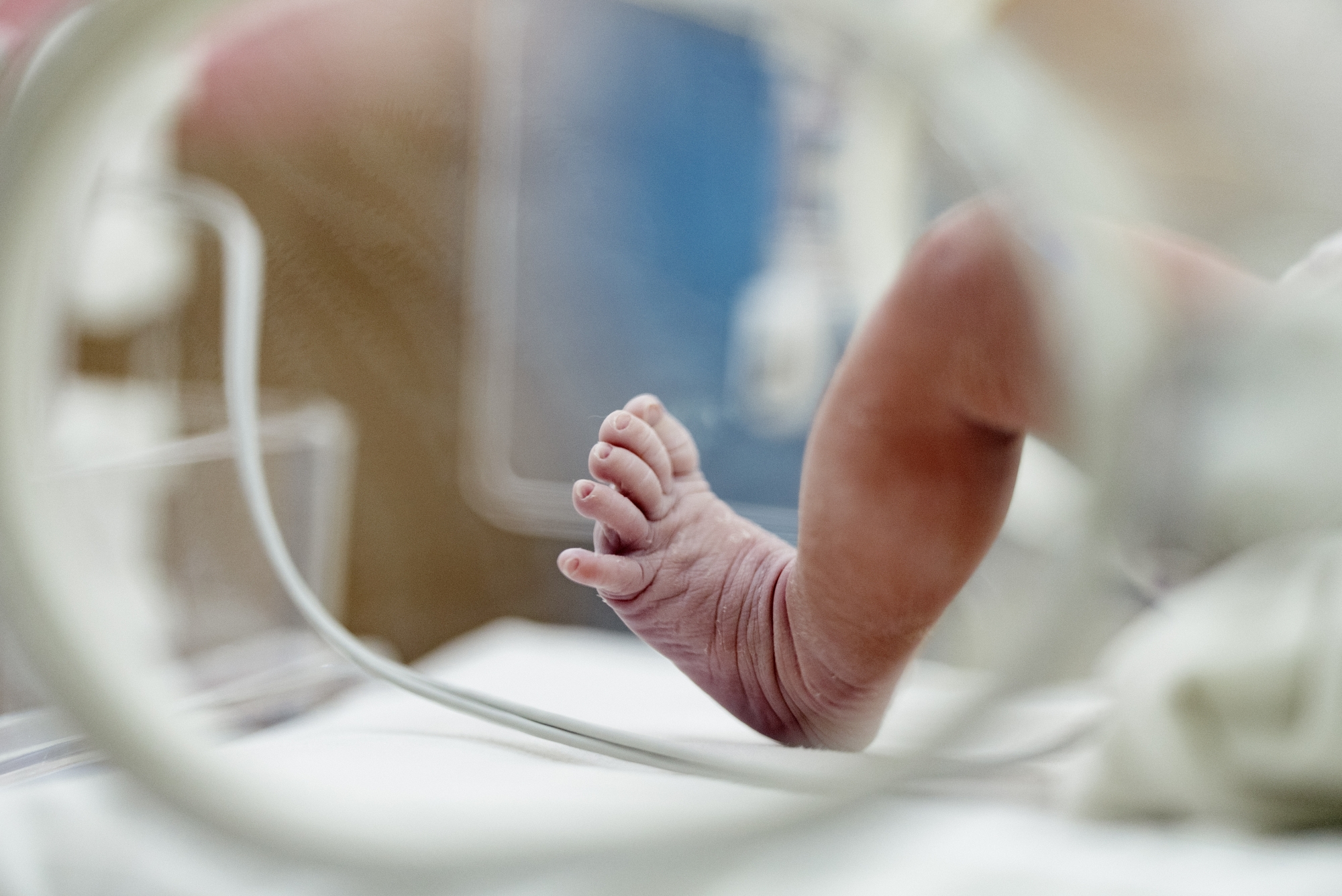 Né à seulement 21 semaines, le bébé le plus prématuré au monde fête ses 2 ans