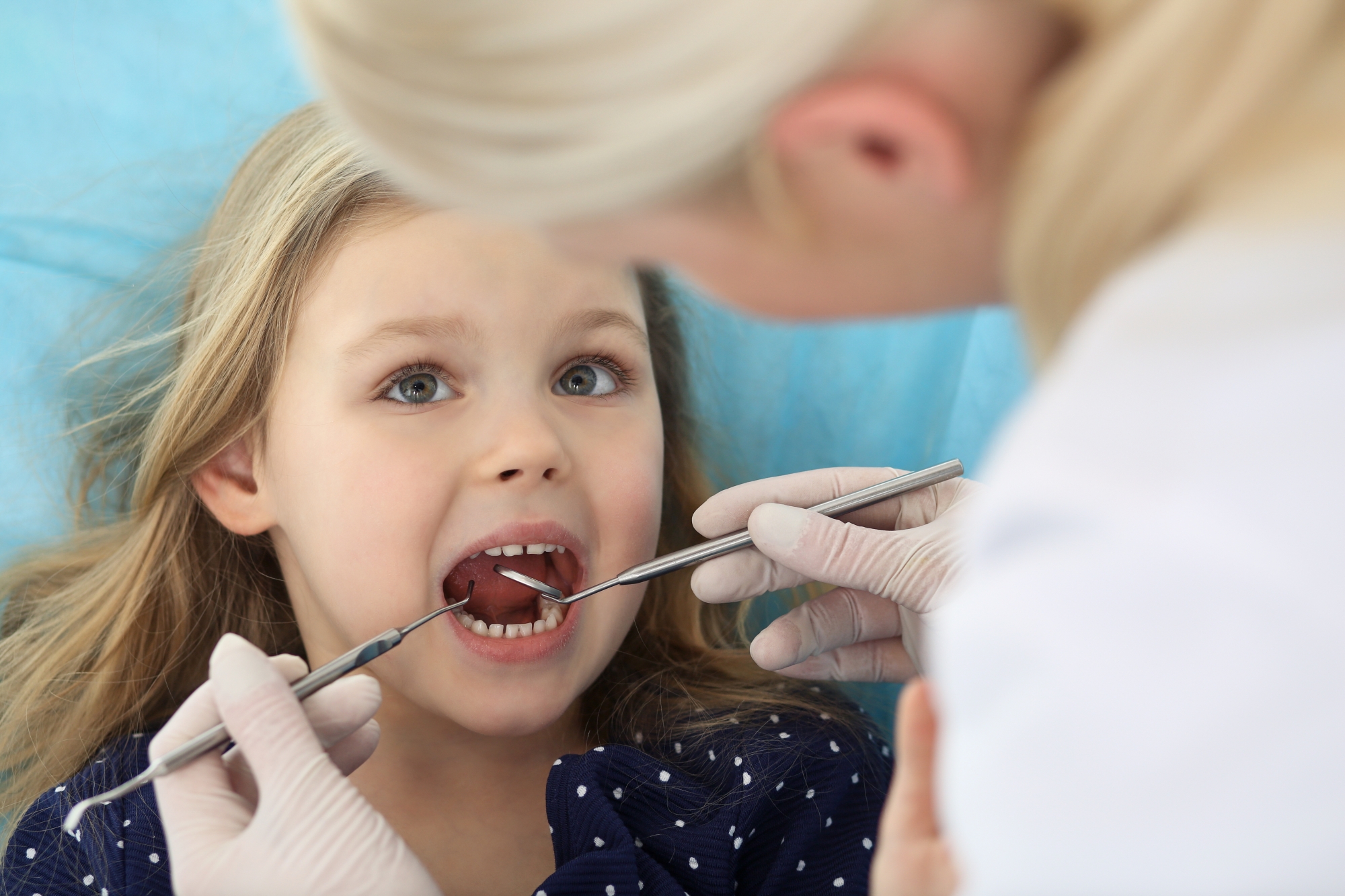 Ce nouveau produit appliqué en quelques secondes peut stopper certaines caries
