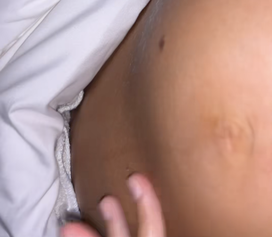 Elle panique en découvrant la forme de son ventre de grossesse en pleine nuit, le diagnostic la ras