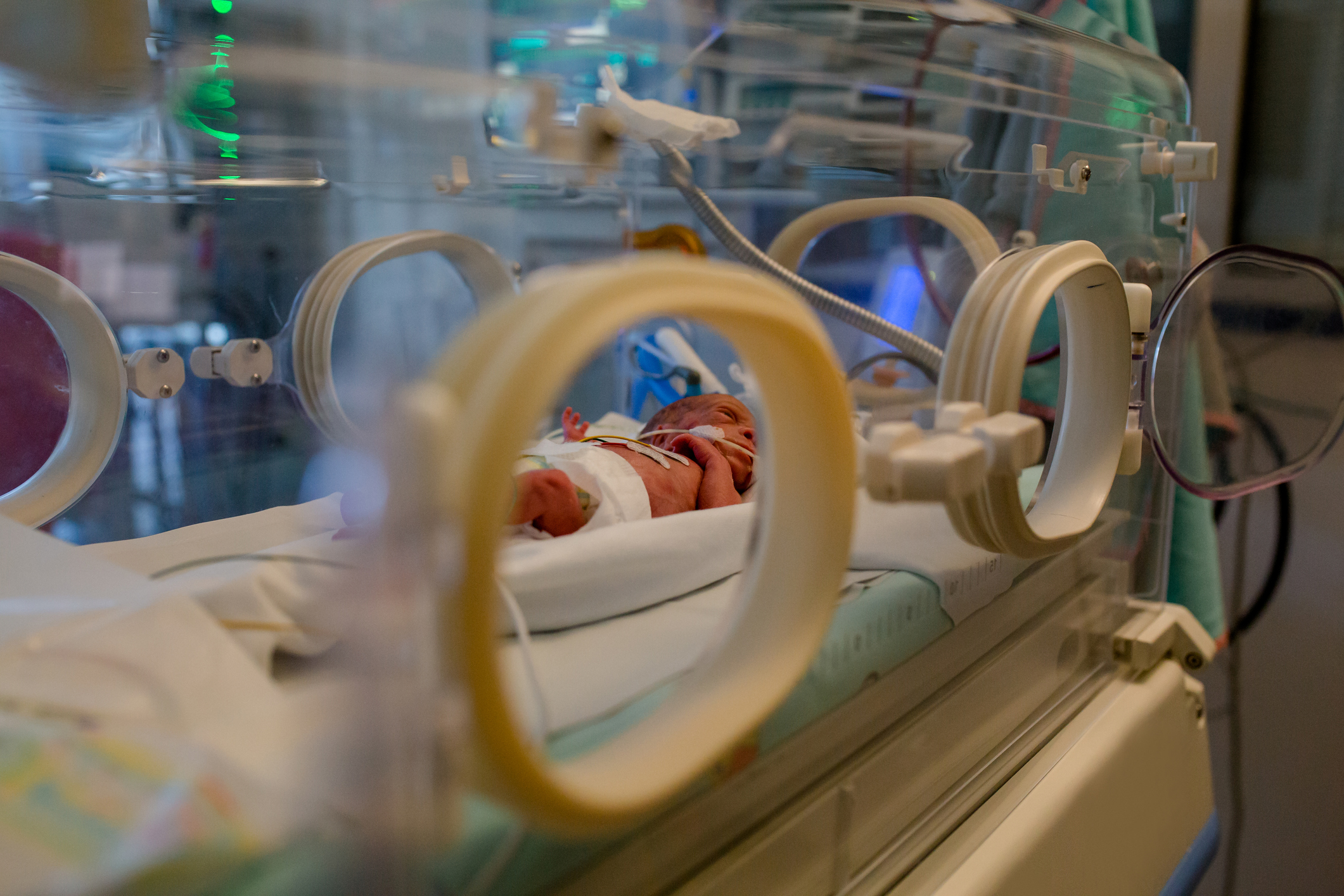 Prématuré : survie miraculeuse d'une fille née à seulement 351 g !