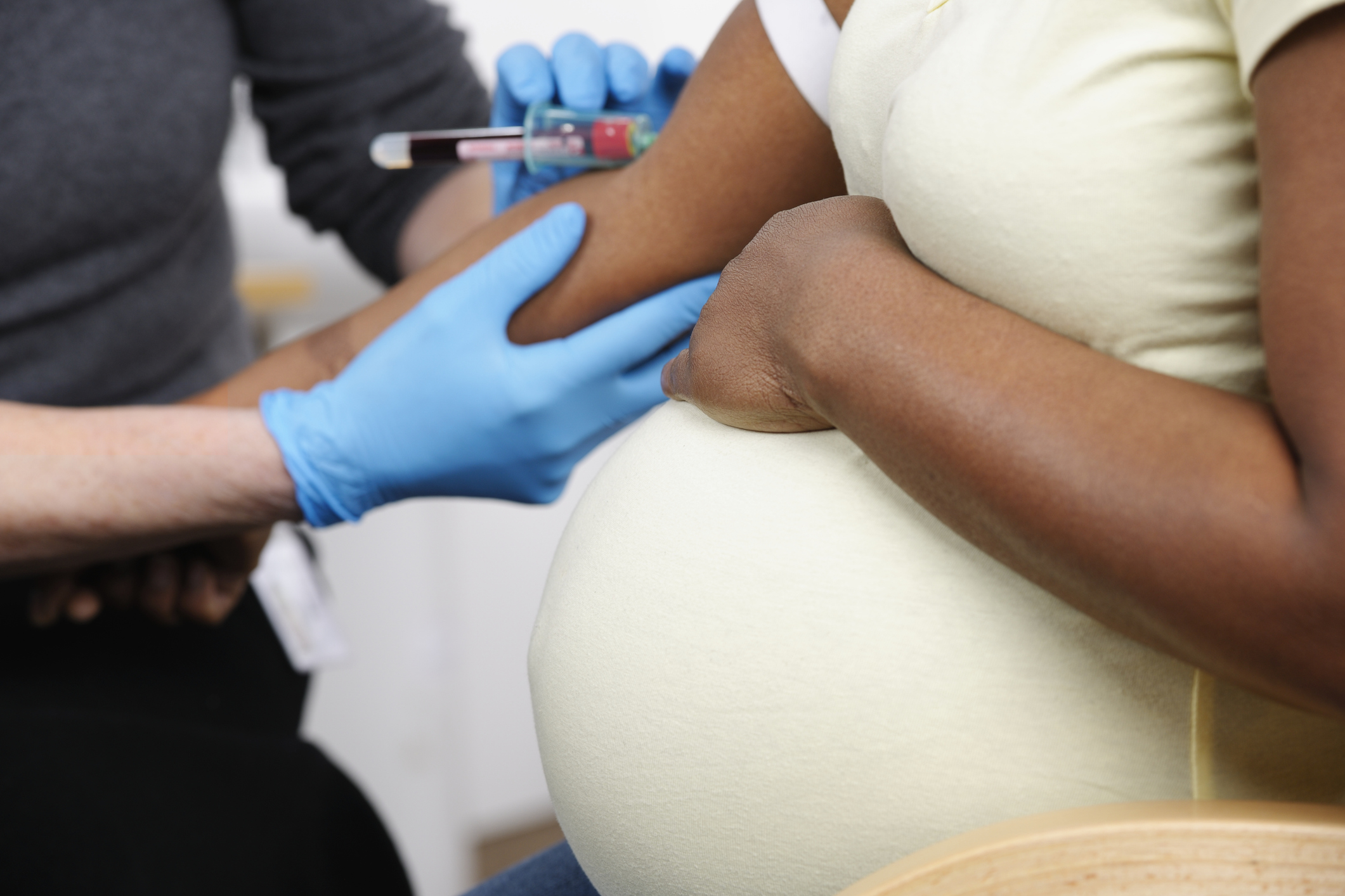 L’anémie pendant la grossesse aurait des conséquences sur le volume du cerveau du bébé