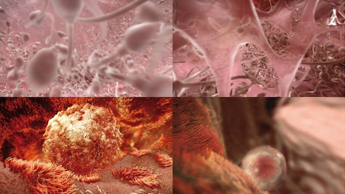 Po74d Kb87nesm Po74d Kb87nesm